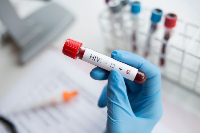 Účtovník nakazil desiatky žien vírusom HIV, dostal 24 rokov