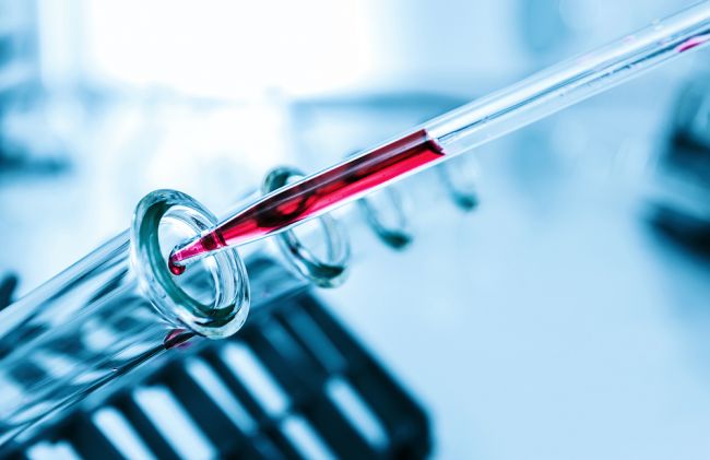 Nový druh krvného testu bude schopný včas odhaliť 8 druhov rakoviny