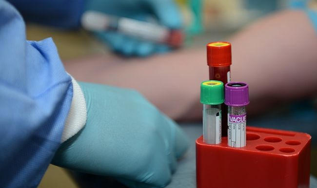 Odborníci odobrali krv stovkám Slovákov, pripravujú imunologický prehľad
