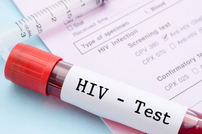 V prvej polovici roka na Slovensku pribudlo 52 nových prípadov HIV infekcie