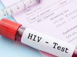 V prvej polovici roka na Slovensku pribudlo 52 nových prípadov HIV infekcie
