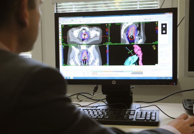 Onkologické ochorenia by mali Slovákom odhaliť rýchlejšie