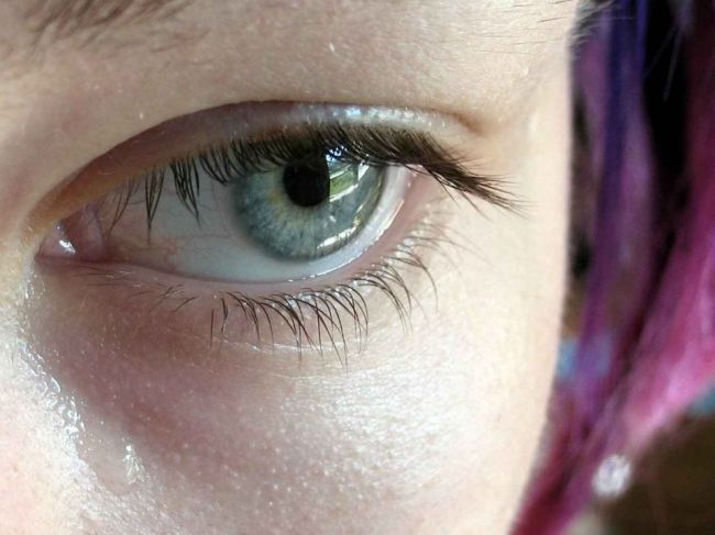 Suché oči: 6 tipov, ako im pomôcť aj bez kvapiek