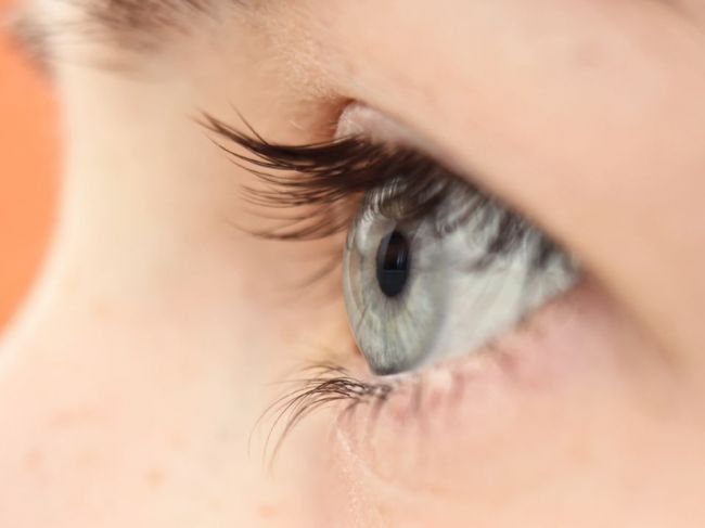 Po zverejnení tejto fotografie si tisíce ľudí začali uvedomovať, že trpia astigmatizmom