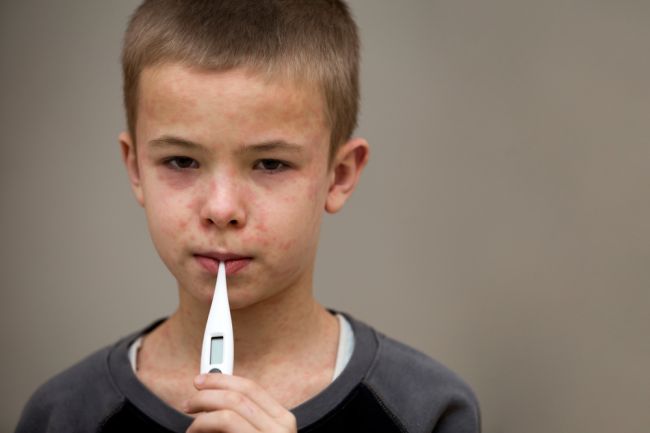 8 mýtov o očkovaní, ktoré vedú k epidémií osýpok