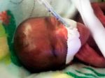VIDEO: V Kalifornii sa narodilo najmenšie dieťa, ktoré prežilo