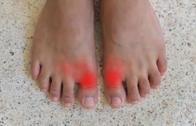artróza palca na nohe)