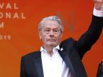 Francúzsky herec Alain Delon mal mozgovú porážku