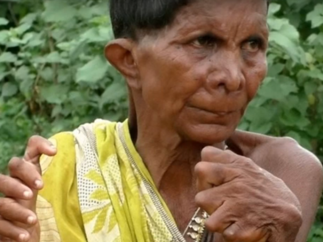 Video: Žena sa narodila s 32 prstami, jej okolie si myslí, že je čarodejnica
