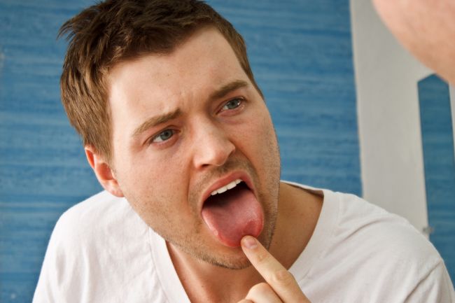 Rakovina jazyka: Prvotné príznaky, ktoré nesmiete ignorovať