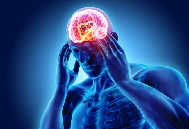 Pravidelná bolesť hlavy: Toto sú príčiny popoludňajších bolestí hlavy a ako ich zastaviť
