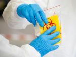 Vedci EÚ vyvinuli materiál, ktorý predíde zlyhaniam pri testoch na COVID-19