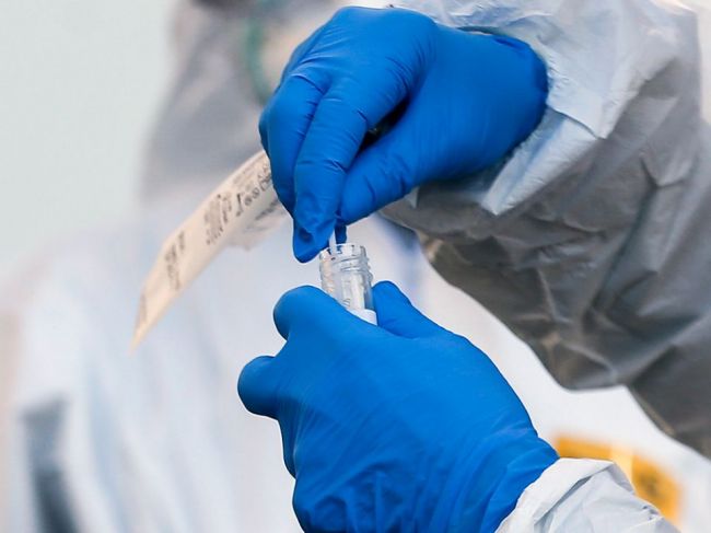 Ministerstvo vnútra varuje pred podvodníkmi s testami na koronavírus