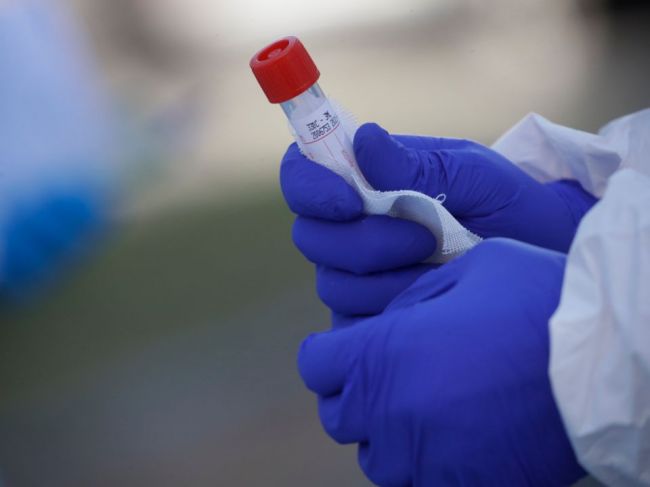 Najmenej 74 vyliečených ľudí v Južnej Kórei malo znovu pozitívny test