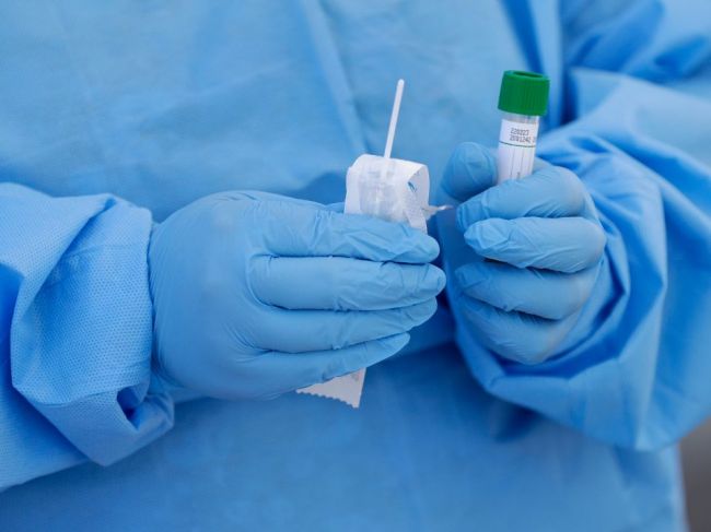 NCZI pripomína, čo treba urobiť pred vyšetrením na ochorenie COVID-19