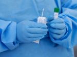 NCZI pripomína, čo treba urobiť pred vyšetrením na ochorenie COVID-19