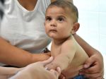 WHO: Hrozí, že pre pandémiu bude 117 miliónov detí nezaočkovaných proti osýpkam