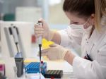 Eurokomisia vydala usmernenia k metódam testovania na nový typ koronavírusu