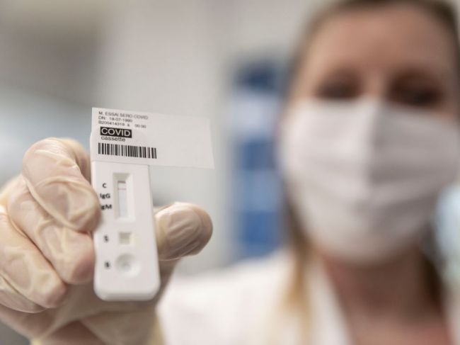 ŠÚKL varuje: Nekupujte si rýchlotesty na diagnostiku koronavírusu z internetu