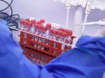 Testy potvrdili COVID-19 u piatich zamestnancov ďalšej slovenskej nemocnice
