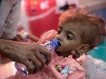 WFP: Svet čelí hrozbe rozsiahlych hladomorov "biblických rozmerov"