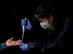 V Česku sa koronavírusom nakazilo ďalších 61 ľudí, dvaja pacienti zomreli