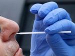 V utorok na Slovensku zaznamenali 9 nových prípadov nákazy COVID-19