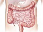 Mužovi museli vyoperovať 13 kg stolice. Hirschsprungova choroba trápi najmä deti