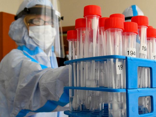 V okrese Čadca eviduje RÚVZ päť prípadov nákazy novým koronavírusom