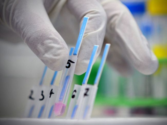 Čínski vedci objavili nový druh prasacej chrípky, ktorý môže spôsobiť pandémiu