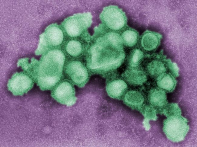 Čínske vedenie bagatelizuje štúdiu o potenciáli nového typu prasacej chrípky