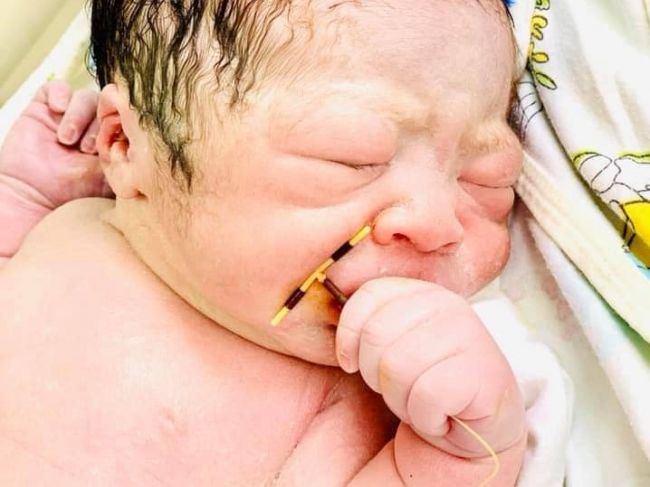 Foto: Bábätko prekvapilo lekárov, s týmto sa narodilo v ruke