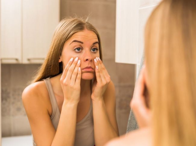 Od alergie po absces – 11 dôvodov, prečo vám opuchla tvár