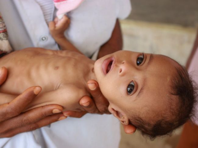 OSN: Takmer 690 miliónov ľudí na svete trpí hladom, pandémia situáciu zhoršuje