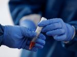 Pribudli desiatky nových prípadov koronavírusu
