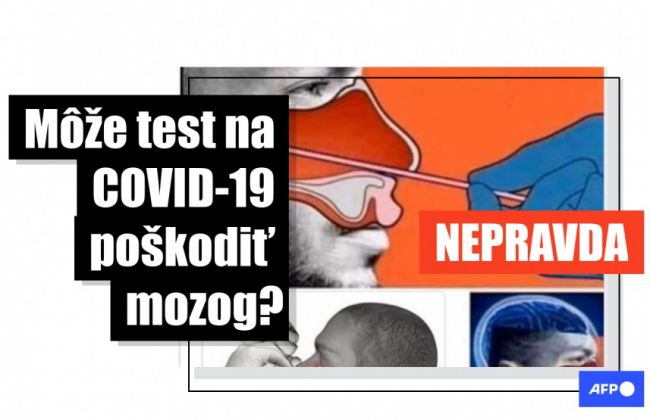 Môže test na COVID-19 poškodiť mozog? Slováci uverili hoaxu