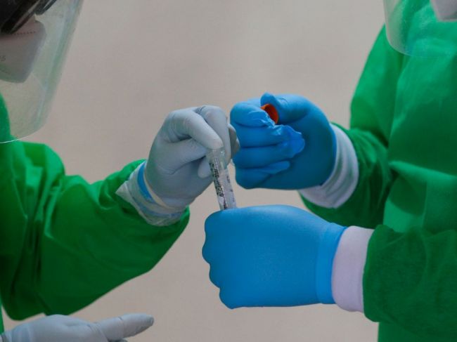 V júli každý deň zistili priemerne 21 nakazených novým koronavírusom, najčastejšie mladých