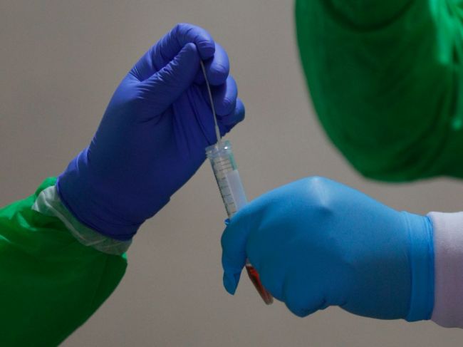 Regionálny úrad verejného zdravotníctva BA uviedol detaily o nových prípadoch nákazy