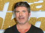 Obávaný porotca Simon Cowell si pri skúšaní nového bicykla poranil chrbát
