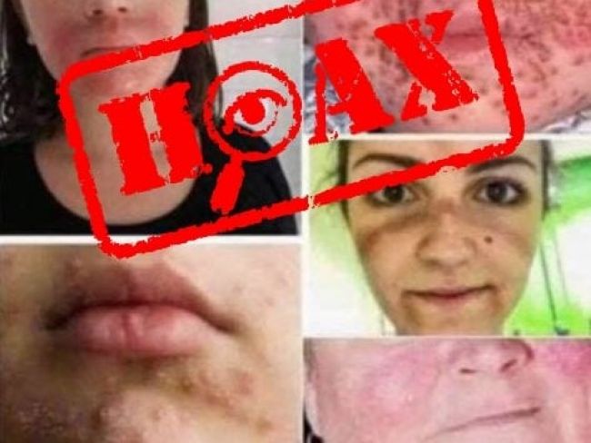 Polícia vyvracia mýty o rúškach: Nespôsobujú alergiu ani neoslabujú imunitu!