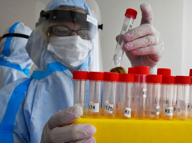 Situácia je podľa ÚVZ pod kontrolou, hygienici vysvetľujú nárast prípadov