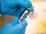 Alpha Medical: Takmer jedno percento z 10.100 testovaných prekonalo Covid-19