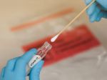 NCZI hlási výpadok mobilnej aplikácie, testovanie na COVID-19 ale funguje
