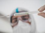 Združenie všeobecných lekárov podporuje realizáciu celoplošného testovania populácie