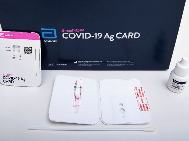 Na odhalenie nového koronavírusu sa využívajú tri typy testov