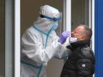 Negatívny test si od vás môže vypýtať aj zamestnávateľ