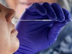 Pribudlo takmer 2000 nakazených, počet testov bol v nedeľu opäť vysoký