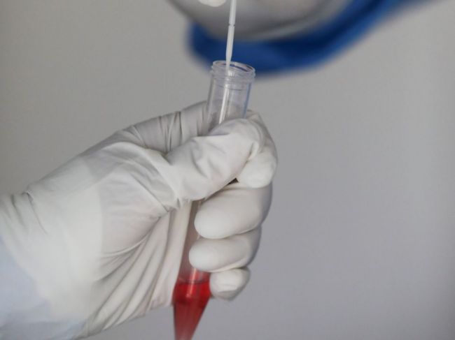 Pribudlo vyše 500 nakazených, stúpol aj počet obetí ochorenia COVID-19