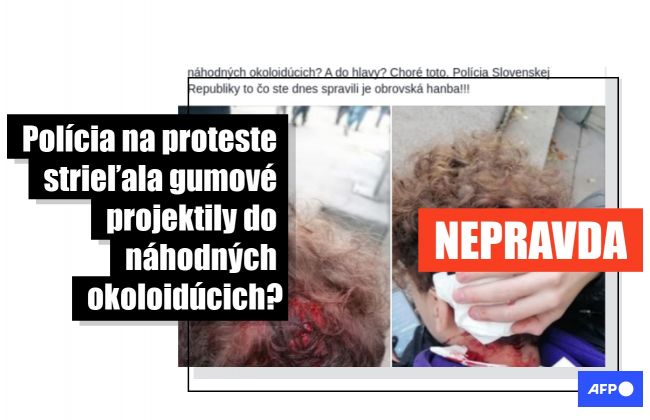 HOAX: Mladíka na proteste 17. novembra nezasiahol policajný gumový projektil