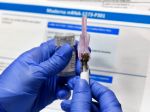USA schválili druhú vakcínu proti COVID-19, od spoločnosti Moderna